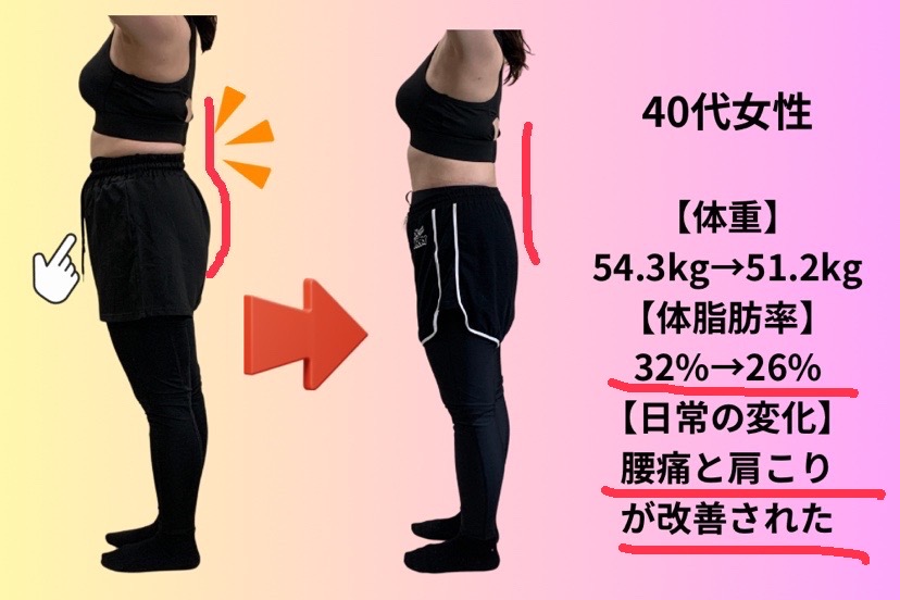 姿勢改善ビフォーアフター1